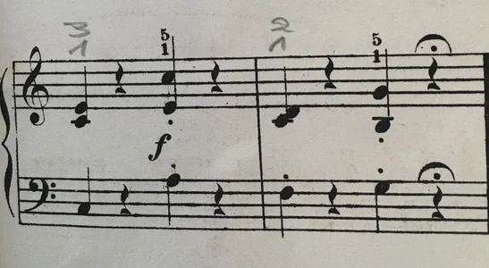 E77B436E-5712-4293-8BCD-12B2C9744135.webp E77B436E-5712-4293-8BCD-12B2C9744135.webp