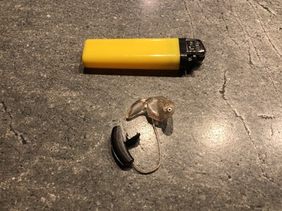 Otoplastik.JPG