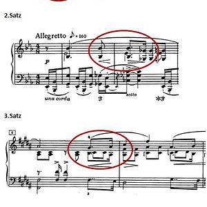 Rhythmische Urzelle in den Sätzen.JPG